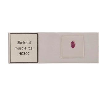 Skeletal muscle t.s.
