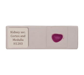 Kidney sec, w cortex & medulla