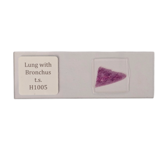 Lung sec. w bronchus t.s.
