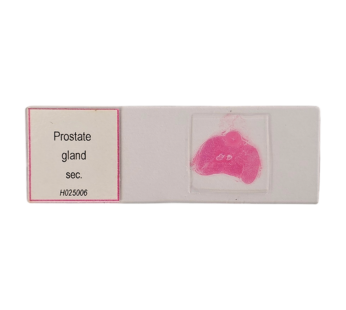 Prostate gland