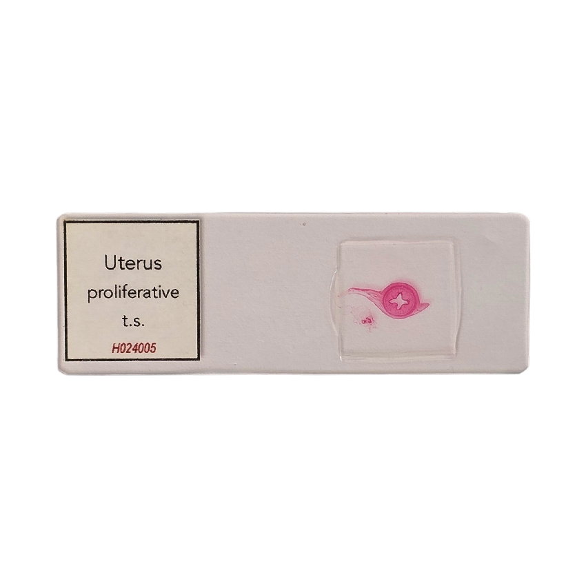 Uterus proliferative